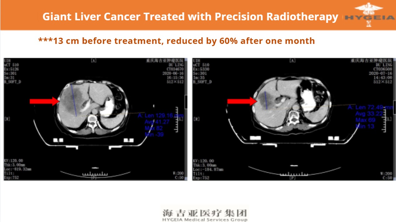 Patient testimonial 3